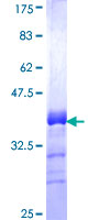 ZNF254 Protein - 12.5% SDS-PAGE Stained with Coomassie Blue.