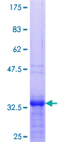 ZNF256 Protein - 12.5% SDS-PAGE Stained with Coomassie Blue.