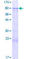 ZNF257 Protein - 12.5% SDS-PAGE of human ZNF257 stained with Coomassie Blue