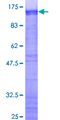 ZNF263 Protein - 12.5% SDS-PAGE of human ZNF263 stained with Coomassie Blue