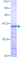 ZNF263 Protein - 12.5% SDS-PAGE Stained with Coomassie Blue.