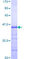 ZNF263 Protein - 12.5% SDS-PAGE Stained with Coomassie Blue.