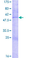 ZNF266 Protein - 12.5% SDS-PAGE of human ZNF266 stained with Coomassie Blue