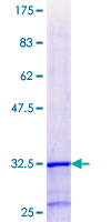 ZNF266 Protein - 12.5% SDS-PAGE Stained with Coomassie Blue.
