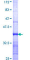 ZNF267 Protein - 12.5% SDS-PAGE Stained with Coomassie Blue.