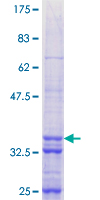 ZNF268 Protein - 12.5% SDS-PAGE Stained with Coomassie Blue.