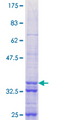 ZNF268 Protein - 12.5% SDS-PAGE Stained with Coomassie Blue.