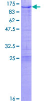 ZNF274 Protein - 12.5% SDS-PAGE of human ZNF274 stained with Coomassie Blue