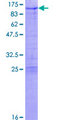 ZNF274 Protein - 12.5% SDS-PAGE of human ZNF274 stained with Coomassie Blue