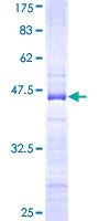 ZNF274 Protein - 12.5% SDS-PAGE Stained with Coomassie Blue.