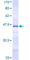 ZNF274 Protein - 12.5% SDS-PAGE Stained with Coomassie Blue.