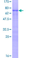ZNF276 Protein - 12.5% SDS-PAGE of human ZFP276 stained with Coomassie Blue