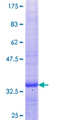ZNF276 Protein - 12.5% SDS-PAGE Stained with Coomassie Blue.