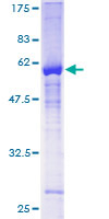 ZNF277 Protein - 12.5% SDS-PAGE of human ZNF277 stained with Coomassie Blue