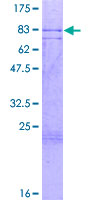 ZNF280A Protein - 12.5% SDS-PAGE of human SUHW1 stained with Coomassie Blue