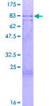 ZNF280A Protein - 12.5% SDS-PAGE of human SUHW1 stained with Coomassie Blue