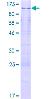 ZNF280C / SUHW3 Protein - 12.5% SDS-PAGE of human ZNF280C stained with Coomassie Blue