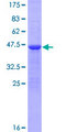 ZNF280D Protein - 12.5% SDS-PAGE of human SUHW4 stained with Coomassie Blue