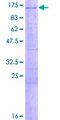 ZNF281 / Zfp281 Protein - 12.5% SDS-PAGE of human ZNF281 stained with Coomassie Blue