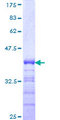 ZNF281 / Zfp281 Protein - 12.5% SDS-PAGE Stained with Coomassie Blue.