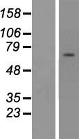 ZNF285 / ZNF285A Protein - Western validation with an anti-DDK antibody * L: Control HEK293 lysate R: Over-expression lysate