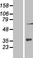 ZNF286A Protein - Western validation with an anti-DDK antibody * L: Control HEK293 lysate R: Over-expression lysate