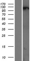 ZNF295 Protein - Western validation with an anti-DDK antibody * L: Control HEK293 lysate R: Over-expression lysate