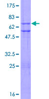 ZNF3 Protein - 12.5% SDS-PAGE of human ZNF3 stained with Coomassie Blue