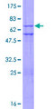 ZNF3 Protein - 12.5% SDS-PAGE of human ZNF3 stained with Coomassie Blue