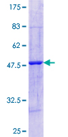 ZNF3 Protein - 12.5% SDS-PAGE Stained with Coomassie Blue.