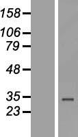 ZNF302 Protein - Western validation with an anti-DDK antibody * L: Control HEK293 lysate R: Over-expression lysate