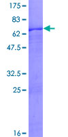 ZNF302 Protein - 12.5% SDS-PAGE of human ZNF302 stained with Coomassie Blue