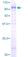 ZNF307 Protein - 12.5% SDS-PAGE of human ZNF307 stained with Coomassie Blue