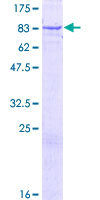 ZNF319 Protein - 12.5% SDS-PAGE of human ZNF319 stained with Coomassie Blue