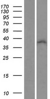 ZNF32 Protein - Western validation with an anti-DDK antibody * L: Control HEK293 lysate R: Over-expression lysate
