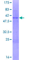 ZNF32 Protein - 12.5% SDS-PAGE of human ZNF32 stained with Coomassie Blue