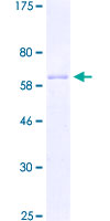 ZNF322 Protein - 12.5% SDS-PAGE of human ZNF322A stained with Coomassie Blue