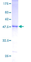 ZNF323 Protein - 12.5% SDS-PAGE of human ZNF323 stained with Coomassie Blue