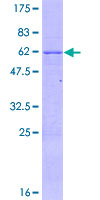 ZNF324 / ZF5128 Protein - 12.5% SDS-PAGE of human ZNF324 stained with Coomassie Blue