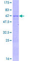 ZNF324 / ZF5128 Protein - 12.5% SDS-PAGE of human ZNF324 stained with Coomassie Blue