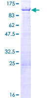 ZNF326 / Zfp326 Protein - 12.5% SDS-PAGE of human ZNF326 stained with Coomassie Blue