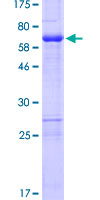 ZNF330 Protein - 12.5% SDS-PAGE of human ZNF330 stained with Coomassie Blue