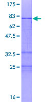 ZNF331 Protein - 12.5% SDS-PAGE of human ZNF331 stained with Coomassie Blue