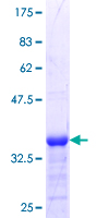 ZNF331 Protein - 12.5% SDS-PAGE Stained with Coomassie Blue.