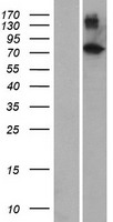 ZNF333 Protein - Western validation with an anti-DDK antibody * L: Control HEK293 lysate R: Over-expression lysate
