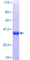 ZNF34 Protein - 12.5% SDS-PAGE Stained with Coomassie Blue.