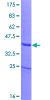 ZNF343 Protein - 12.5% SDS-PAGE of human ZNF343 stained with Coomassie Blue