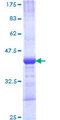 ZNF345 Protein - 12.5% SDS-PAGE Stained with Coomassie Blue.