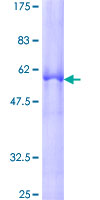 ZNF346 Protein - 12.5% SDS-PAGE of human ZNF346 stained with Coomassie Blue