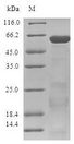 ZNF346 Protein - (Tris-Glycine gel) Discontinuous SDS-PAGE (reduced) with 5% enrichment gel and 15% separation gel.